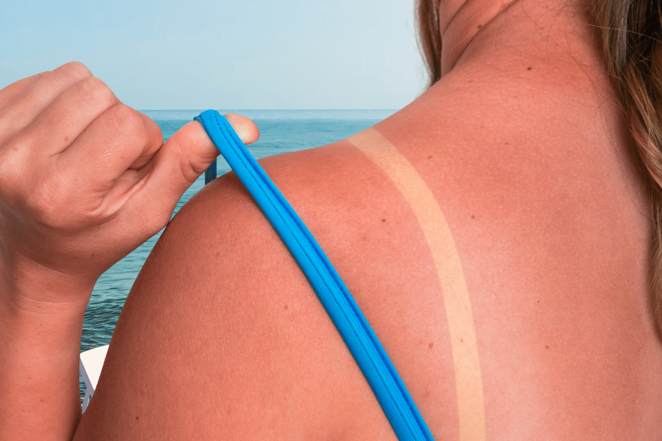 Tomar medicação neste verão? O que você precisa saber sobre a exposição ao sol e ao calor