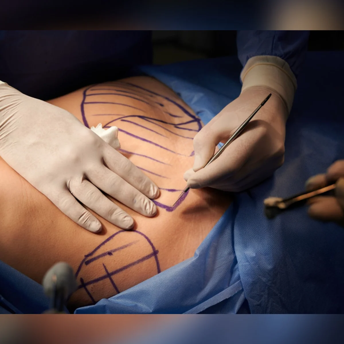 Justiça suspende médico de BH investigado por possíveis erros em cirurgias