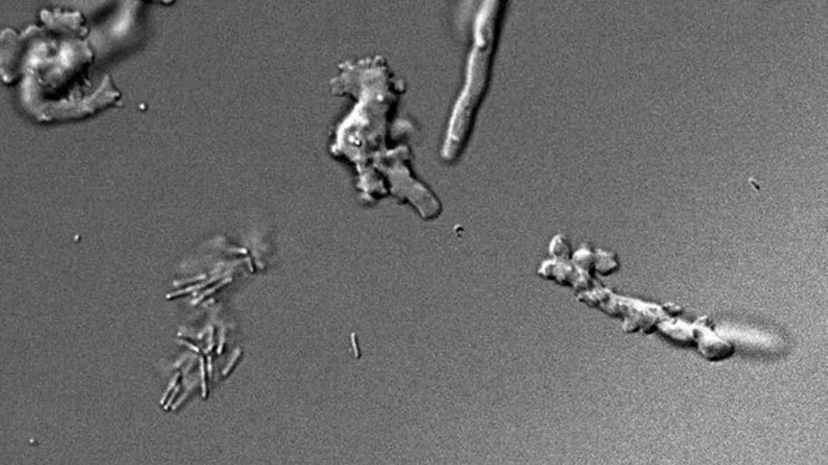 “Ameba de fogo”: cientistas descobrem espécie que sobrevive a 64 °C