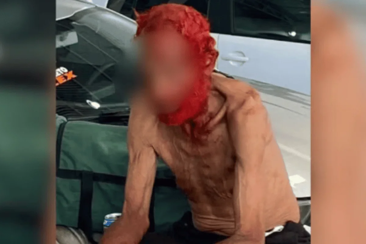 Empresário vira réu por tingir cabelos e barba de idoso em situação de rua
