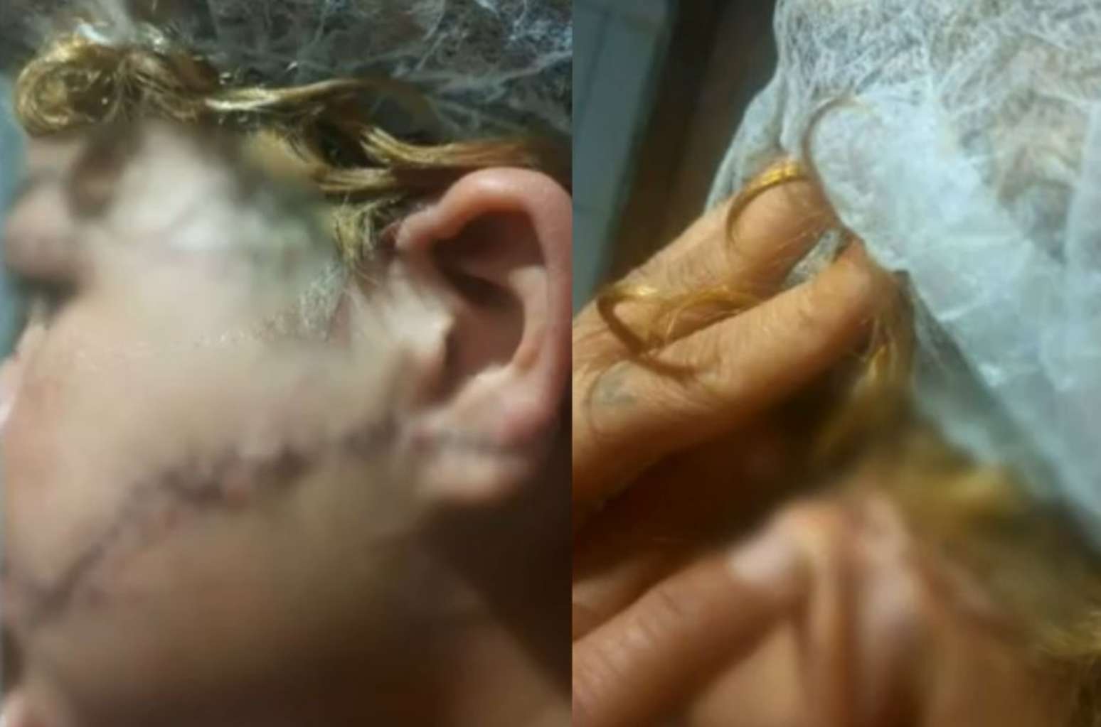 Suspeito teria desfigurado rosto da ex-esposa ao golpe&aacute;-la com uma faca
