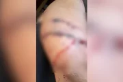 Grávida é atacada com cacos de vidro por namorada do ex-companheiro em GO