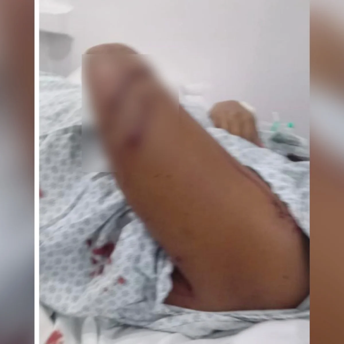 Grávida é atacada com cacos de vidro por namorada do ex-companheiro em GO