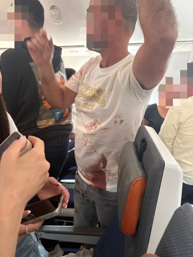 Piloto é esfaqueado na cabine, avião mergulha no ar e voo pousa em emergência