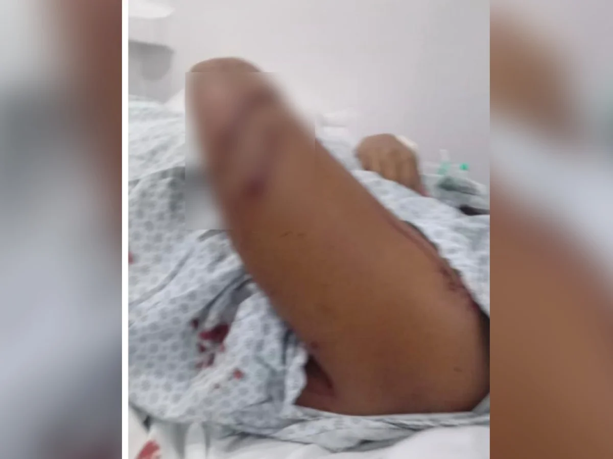 Grávida é atacada com cacos de vidro por namorada do ex-companheiro em GO