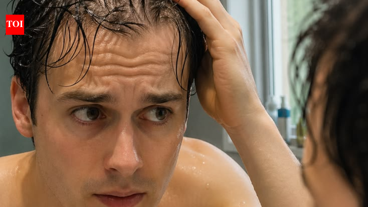 A queda de cabelo em homens indianos jovens está aumentando: estresse, dieta ou genética estão por trás da sua testa recuada?