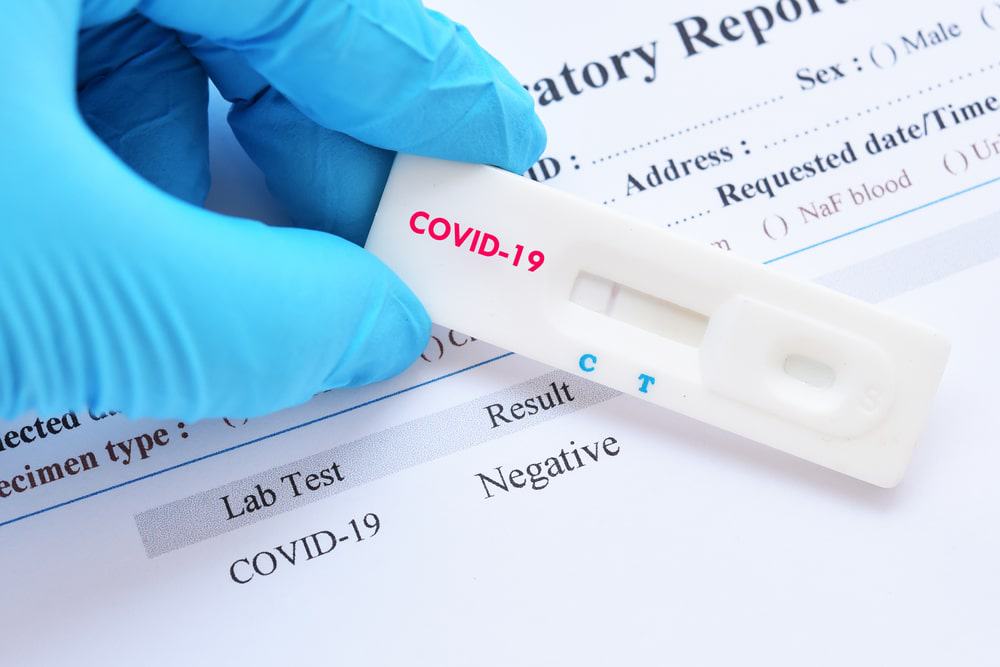 Assim como nos testes rápidos de covid-19, o resultado do drogômetro é exibido na própria fita de teste em cerca de 15 minutos. Imagem: Jarun Ontakrai – Shutterstock