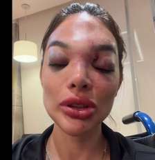 A cirurgiã-dentista Giullia Falcão afirma ter sido agredida pelo marido, o empresário Ivo Kos. Foto: Reprodução/@dragiufalcao via TikTok / Estadão