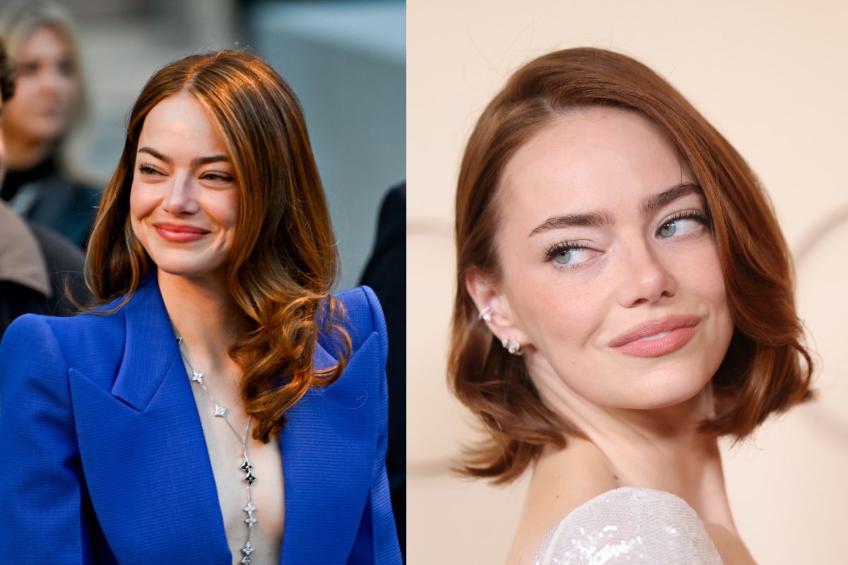 Emma Stone surge com "pele perfeita"; médicos citam possíveis procedimentos